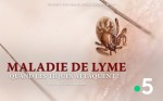 Poster of The Lyme disease, a silent epidemic
